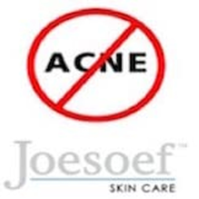 Sulfur Soap for Acne Pharmaceutical Grade Dermatologists Approved for Acne Rosacea 100G